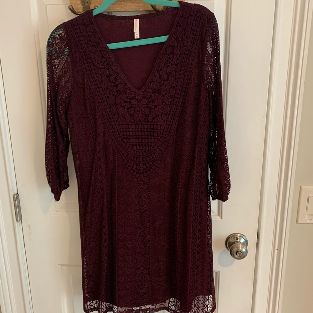 Lace Dress🍍